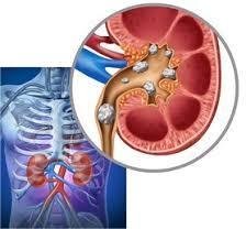 Renal and Urological 